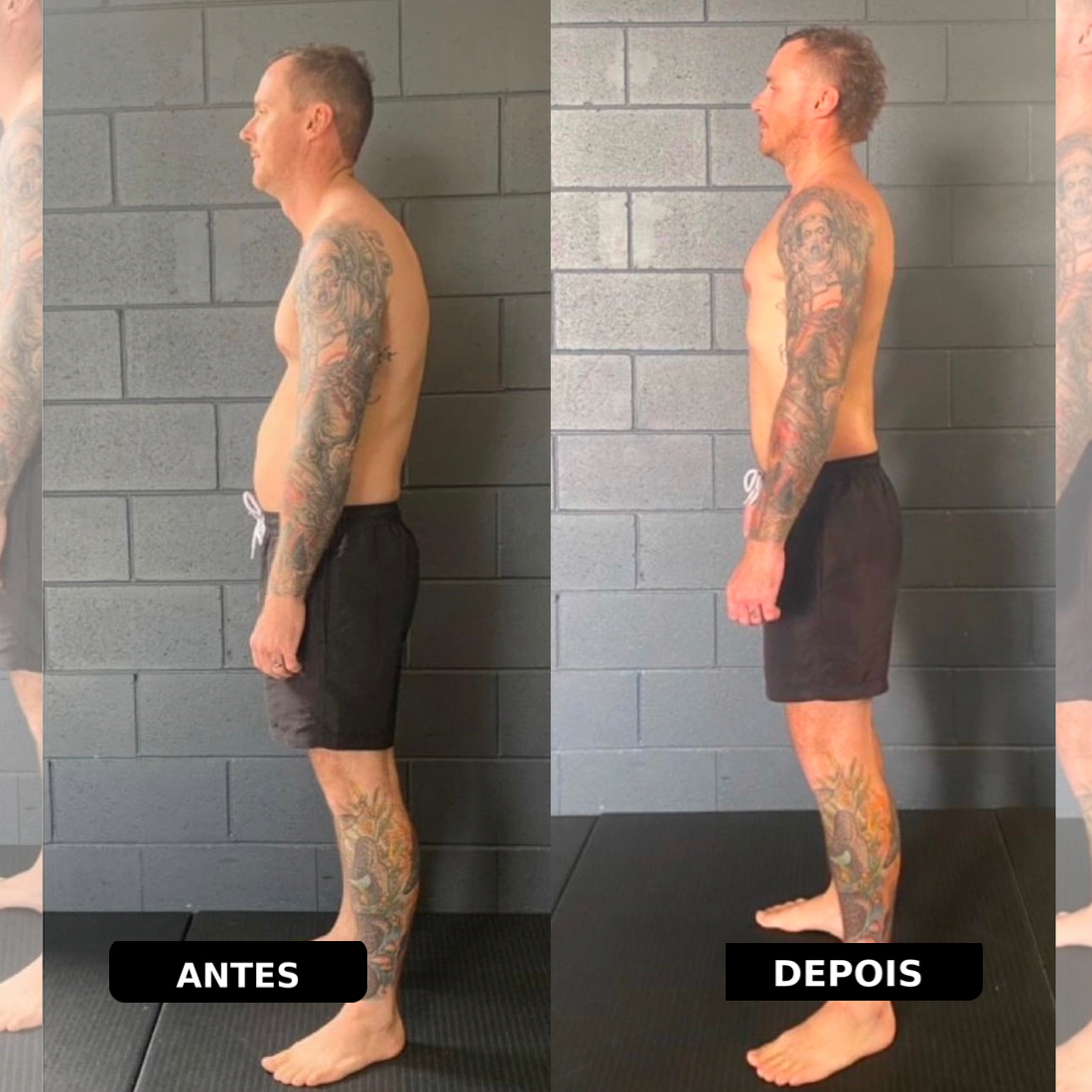 Corretor de Postura Instantâneo