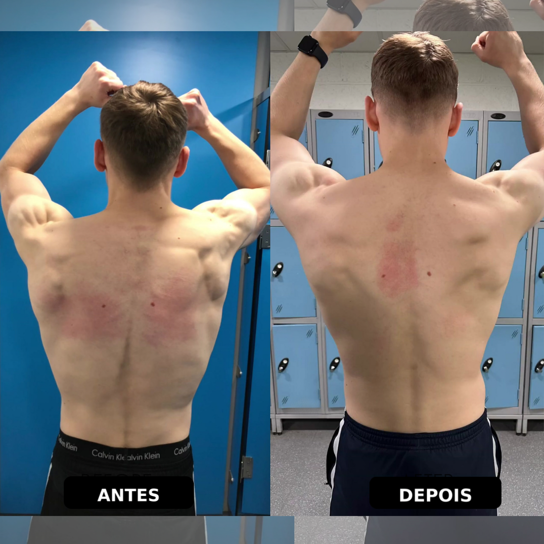 Corretor de Postura Instantâneo